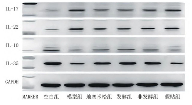 空白組和支氣管哮喘各組大鼠肺組織中IL－17、IL－22、IL－10、IL－35蛋白表達(dá)電泳圖